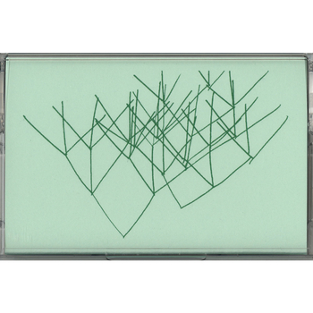 NO I DONT - Whats Your Overtone?